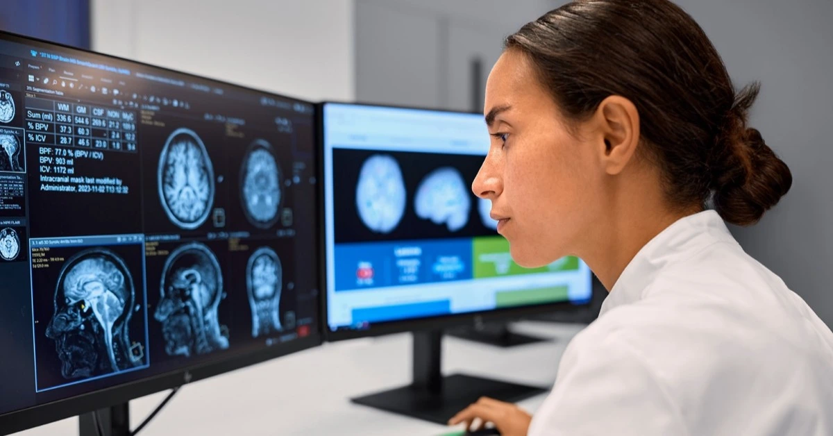 Philips and icometrix debut AI brain imaging tech