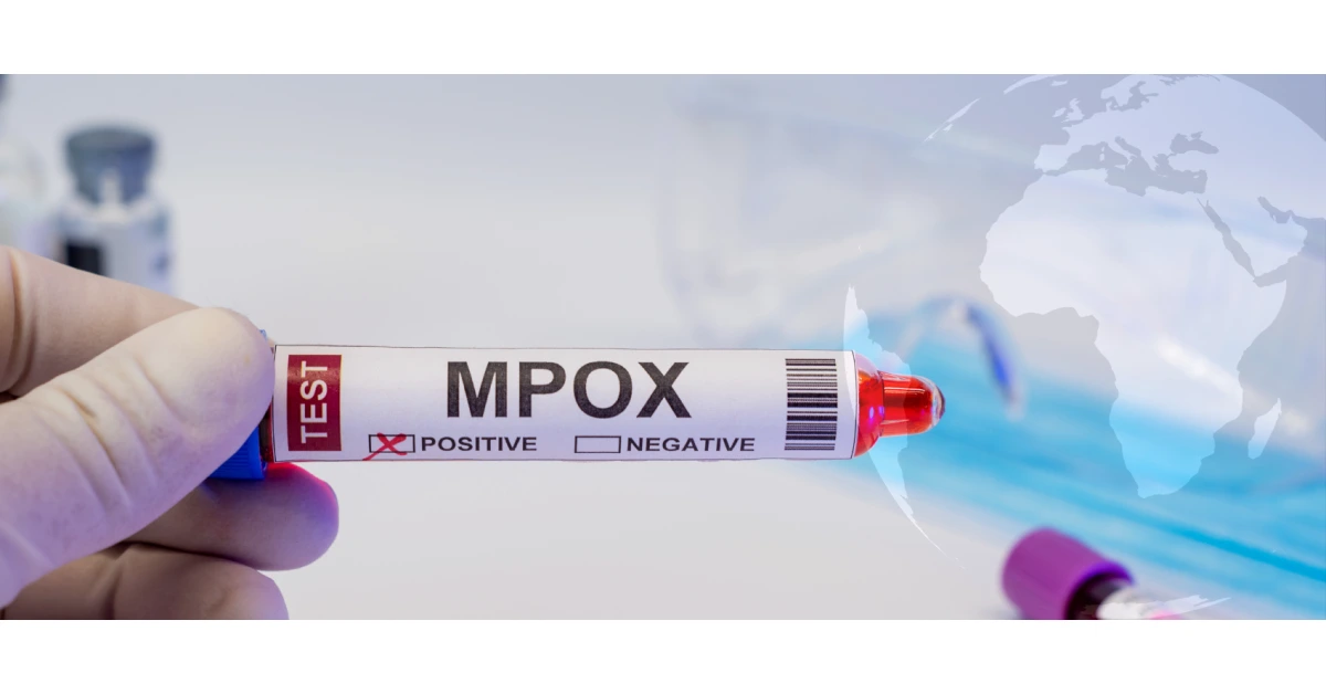 WHO approves Cepheids Xpert Mpox rapid test to support global outbreak response