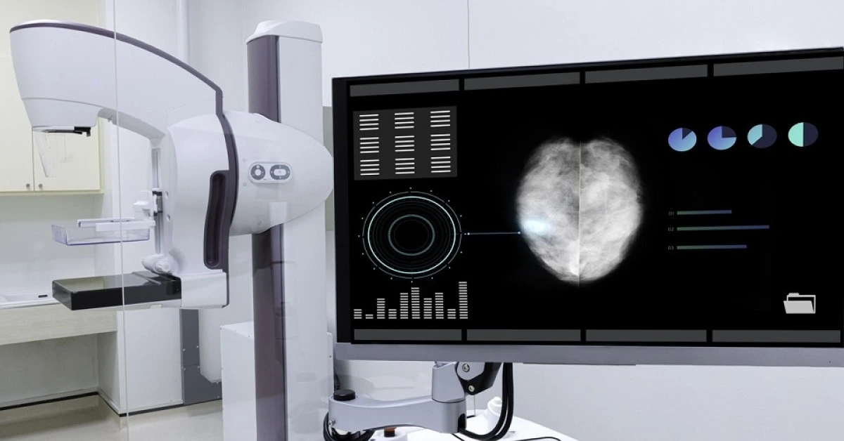 NHS launches AI trial for breast cancer screening