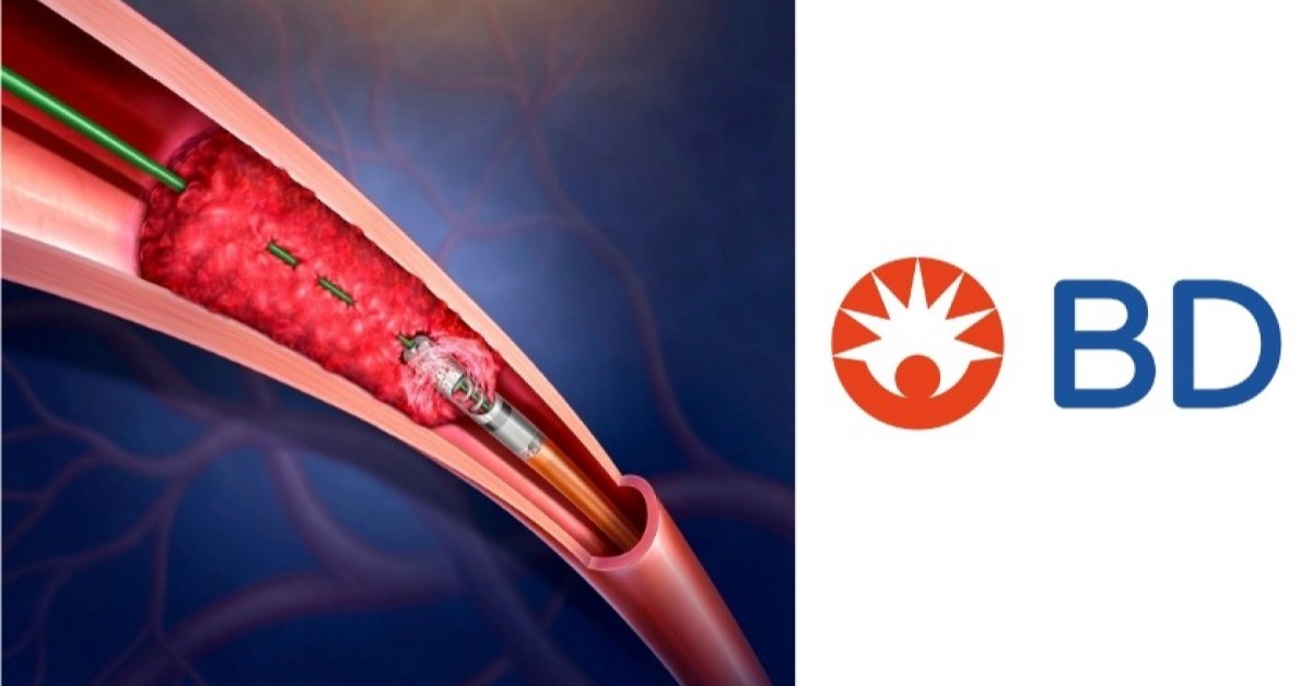 BD launches U.S. registry to track Rotarex PAD outcomes
