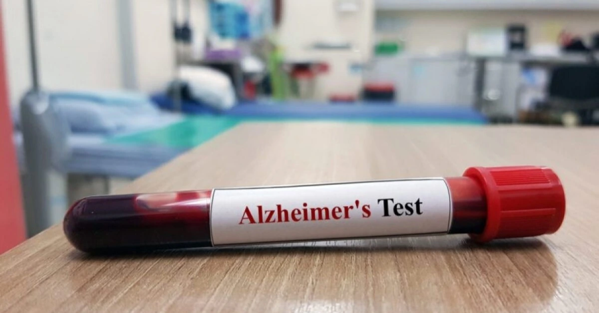FDA clears first Alzheimer’s blood test